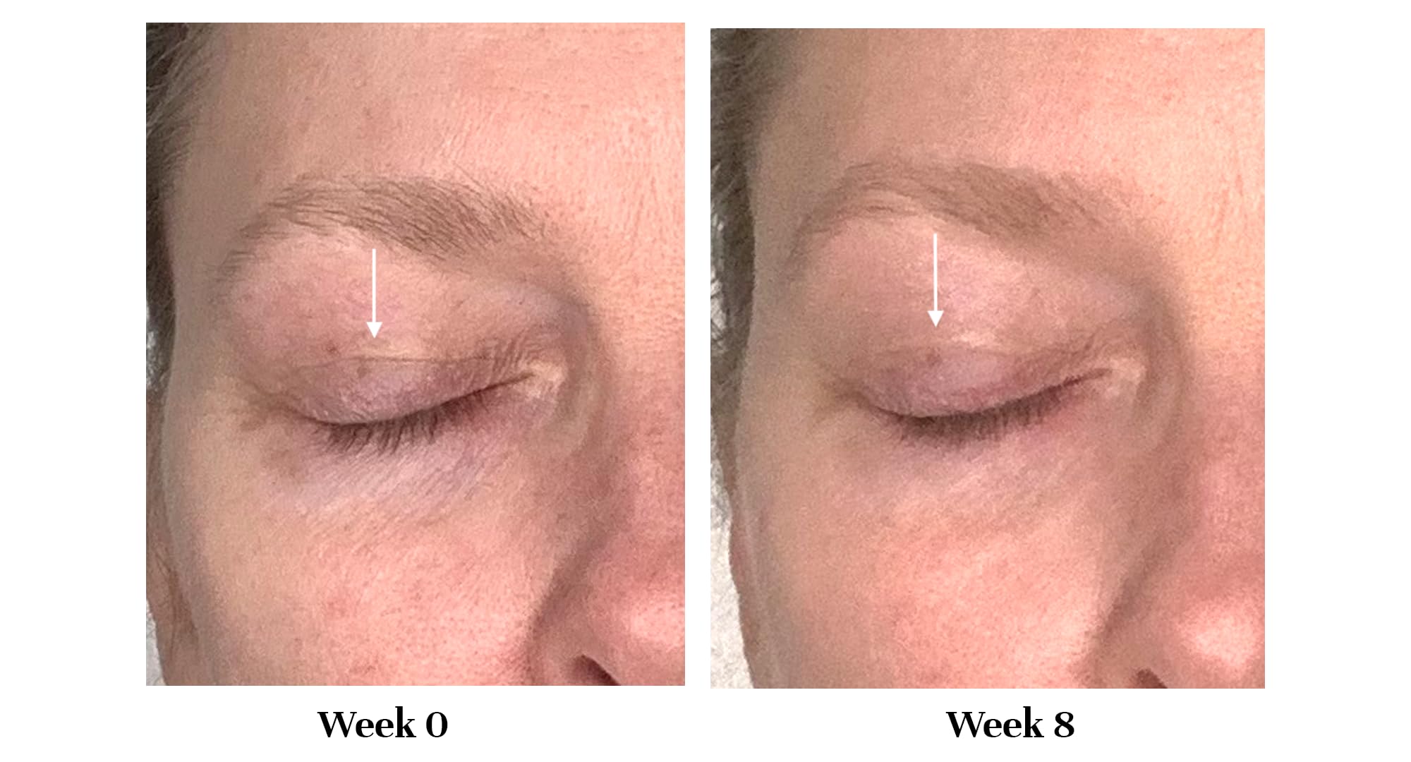 City Beauty Lid Lifting Formula Eye Cream