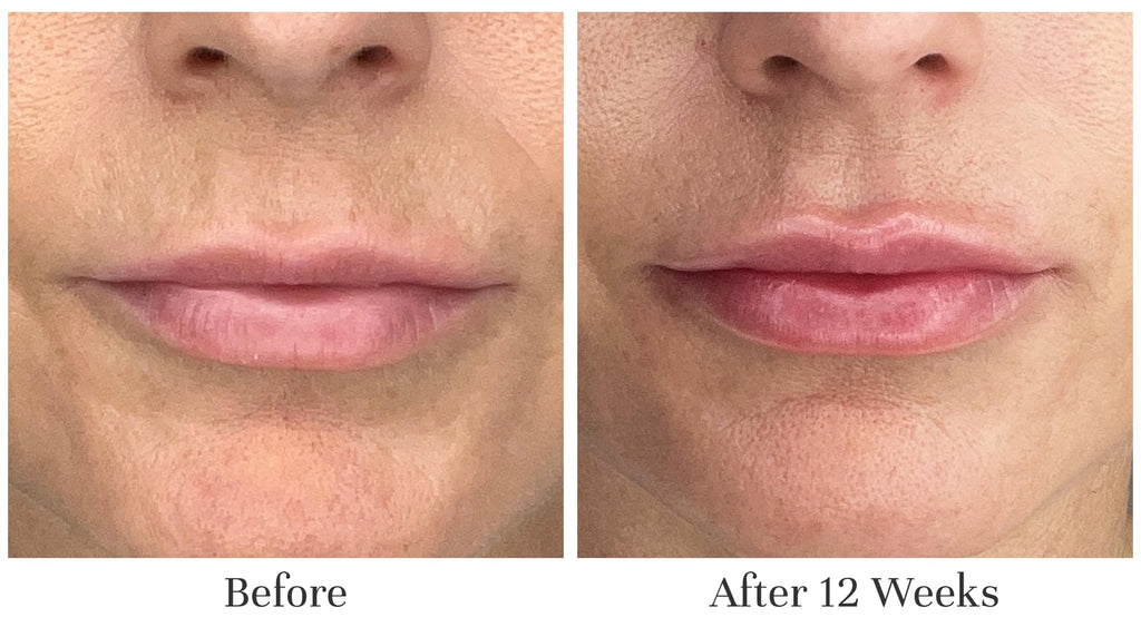 City Beauty Lip Fix+ Bundle – Plumping Gloss, Line Therapy & Night Oil